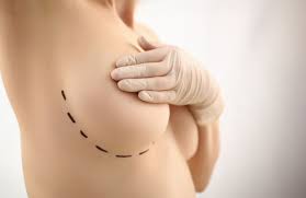 Reconstrução Mamária